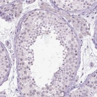 Immunohistochemical staining of human testis shows no positivity in cells in seminiferous ducts as expected.