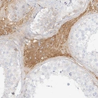 Immunohistochemical staining of human testis shows strong cytoplasmic positivity in Leydig cells.
