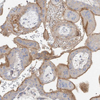 Immunohistochemical staining of human placenta shows moderate membranous positivity in trophoblastic cells.