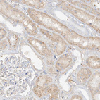 Immunohistochemical staining of human kidney shows moderate cytoplasmic positivity in cells in tubules.