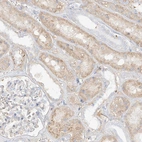 Immunohistochemical staining of human kidney shows moderate cytoplasmic positivity in cells in tubules.