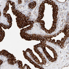 Anti-DHRS7 Antibody
