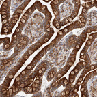 Immunohistochemical staining of human small intestine shows strong membranous positivity in glandular cells.