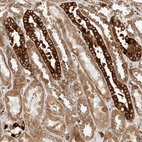 Immunohistochemical staining of human kidney shows moderate membranous positivity in cells in tubules.