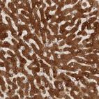 Immunohistochemical staining of human liver shows moderate membranous positivity in hepatocytes.