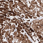 Anti-TRPC7 Antibody