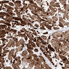 Anti-TRPC7 Antibody