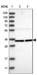 Lane 1: Marker [kDa] 230, 130, 95, 72, 56, 36, 28, 17, 11_br/_Lane 2: Human cell line RT-4_br/_Lane 3: Human cell line U-251MG sp