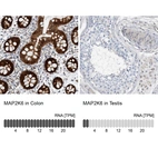 Anti-MAP2K6 Antibody