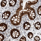 Immunohistochemical staining of human colon shows high expression.