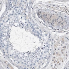 Immunohistochemical staining of human testis shows low expression as expected.