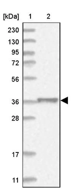 Lane 1: Marker [kDa] 230, 130, 95, 72, 56, 36, 28, 17, 11_br/_Lane 2: Human cell line RT-4
