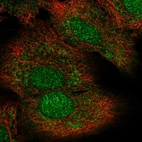 Immunofluorescent staining of human cell line A549 shows localization to nucleus & cytosol.