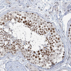 Anti-MCM9 Antibody