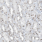 Immunohistochemical staining of human Kidney shows moderate nuclear positivity in cells in tubules.