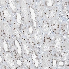 Immunohistochemical staining of human Kidney shows moderate nuclear positivity in cells in tubules.