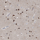 Immunohistochemical staining of human Cerebral cortex shows strong nuclear positivity in neurons and glial cells.