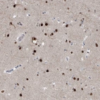 Immunohistochemical staining of human Cerebral cortex shows strong nuclear positivity in neurons and glial cells.