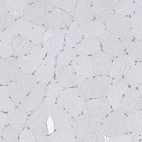 Immunohistochemical staining of human Skeletal muscle shows very weak nuclear positivity in myocytes.