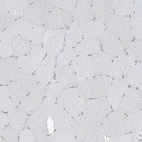 Immunohistochemical staining of human Skeletal muscle shows very weak nuclear positivity in myocytes.