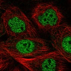 Immunofluorescent staining of human cell line A-431 shows localization to nucleoplasm.