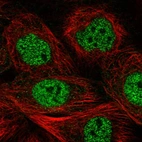 Immunofluorescent staining of human cell line A-431 shows localization to nucleoplasm.