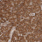 Anti-RPS6 Antibody