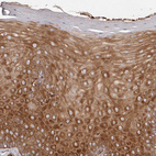 Immunohistochemical staining of human cervix shows strong cytoplasmic positivity in squamous epithelial cells.
