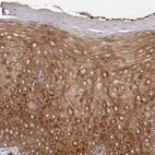 Immunohistochemical staining of human cervix shows strong cytoplasmic positivity in squamous epithelial cells.