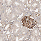 Immunohistochemical staining of human kidney shows strong cytoplasmic positivity in cells in glomeruli.