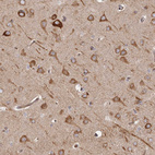 Immunohistochemical staining of human cerebral cortex shows strong cytoplasmic positivity in neurons.