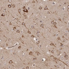 Immunohistochemical staining of human cerebral cortex shows strong cytoplasmic positivity in neurons.