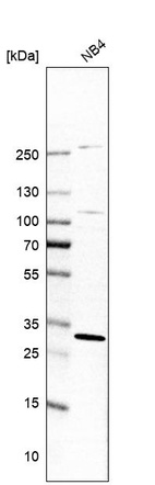 Western blot analysis in human cell line NB4.