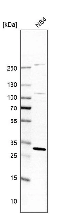 Western blot analysis in human cell line NB4.