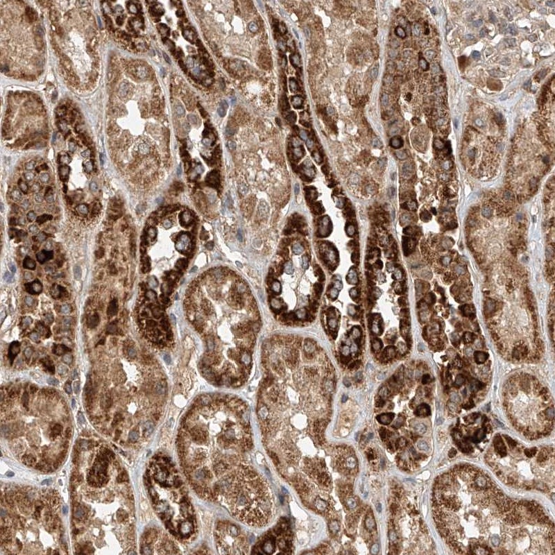 Anti-DCAF11 Antibody