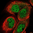 Anti-DCAF11 Antibody