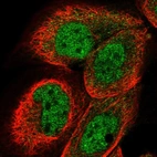 Immunofluorescent staining of human cell line A-431 shows localization to nucleoplasm.