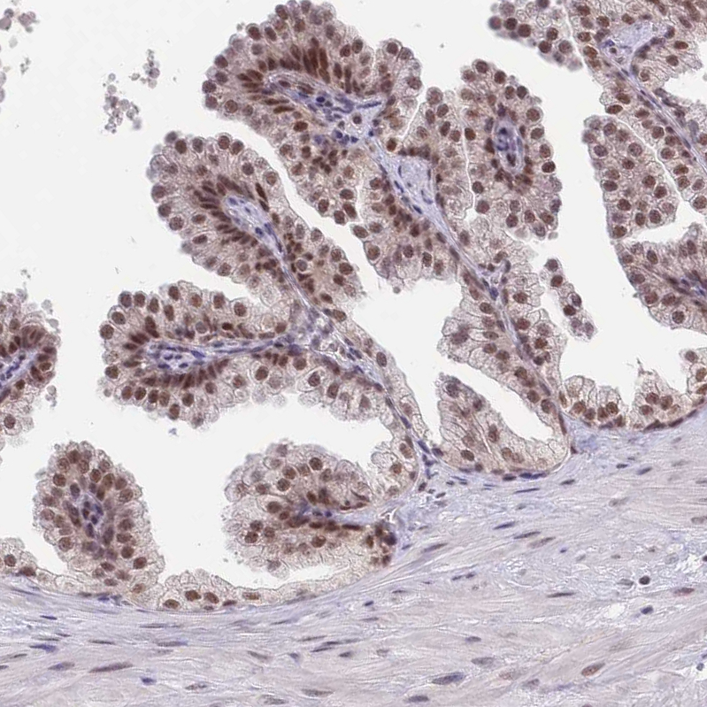 Anti-SMAD9 Antibody