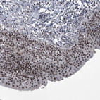 Immunohistochemical staining of human urinary bladder shows moderate positivity in urothelial cells.
