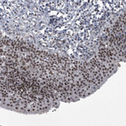 Anti-MLLT1 Antibody