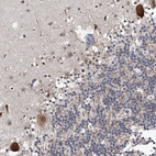 Immunohistochemical staining of human cerebellum shows strong nuclear and cytoplasmic positivity in Purkinje cells.