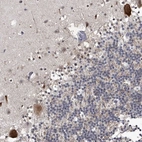 Immunohistochemical staining of human cerebellum shows strong nuclear and cytoplasmic positivity in Purkinje cells.