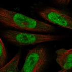 Immunofluorescent staining of human cell line U-251 MG shows localization to nucleoplasm & nucleoli fibrillar center.