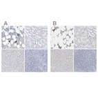 Immunohistochemical staining of human bone marrow, kidney, liver and tonsil using Anti-ITGA2B antibody HPA031168 (A) shows similar protein distribution across tissues to independent antibody HPA031169 (B).