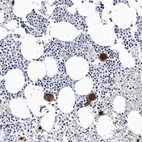 Immunohistochemical staining of human bone marrow shows strong cytoplasmic positivity in hematopoietic cells.