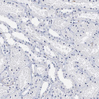 Anti-ITGA2B Antibody