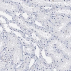 Immunohistochemical staining of human kidney shows no positivity in cells in tubules as expected.