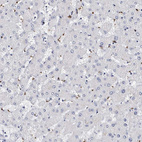 Immunohistochemical staining of human liver shows no positivity in hepatocytes as expected.
