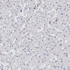 Immunohistochemical staining of human liver shows no positivity in hepatocytes as expected.