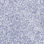 Anti-ITGA2B Antibody